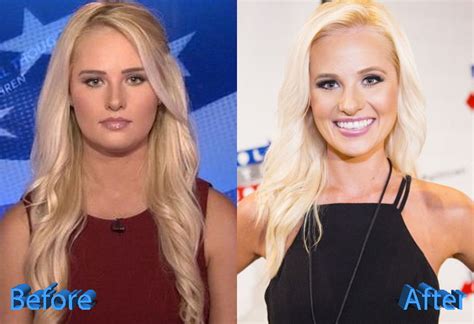 tomi lahren no makeup|tomi lahren cosmetic surgery.